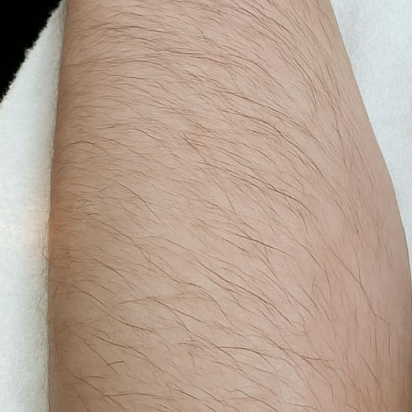 Before-ręka